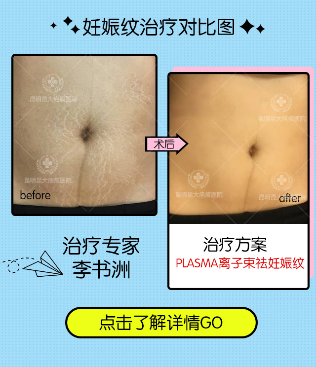 1-1P5041FG2J6.jpg